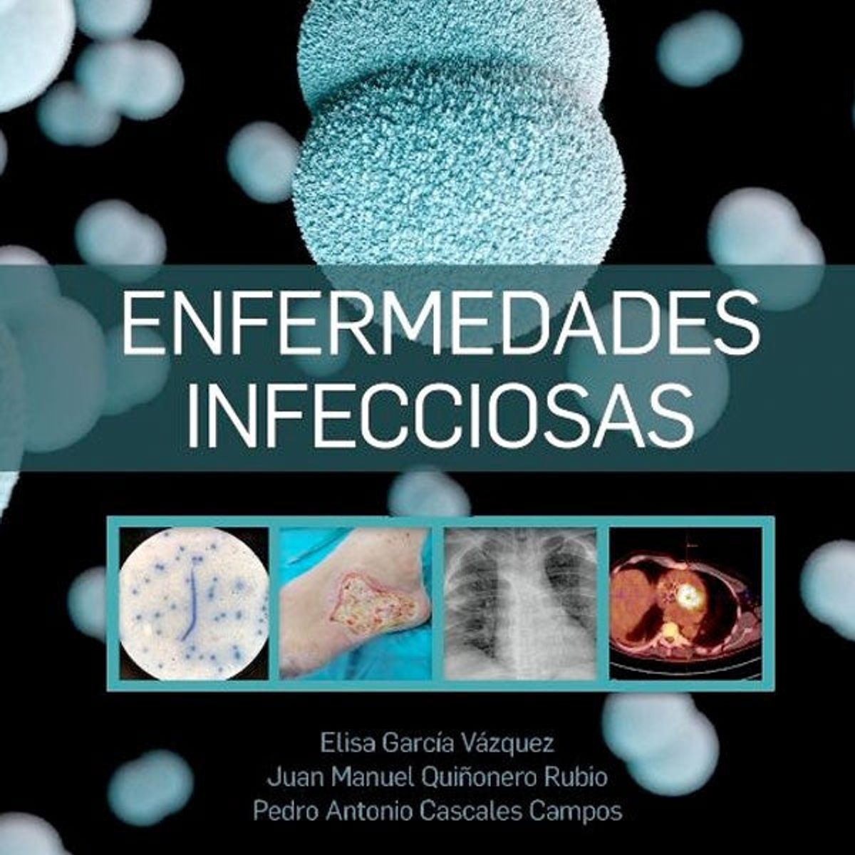 ELSEVIER - Enfermedades infecciosas. Soc. Esp. Enfermedades Infecciosas