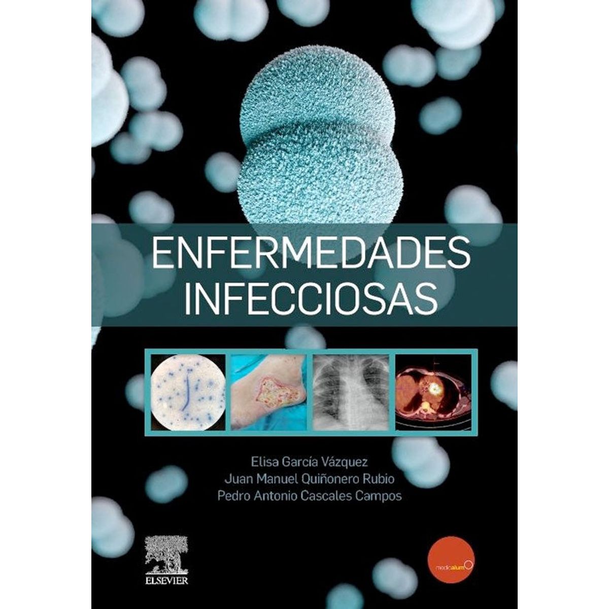 ELSEVIER - Enfermedades infecciosas. Soc. Esp. Enfermedades Infecciosas