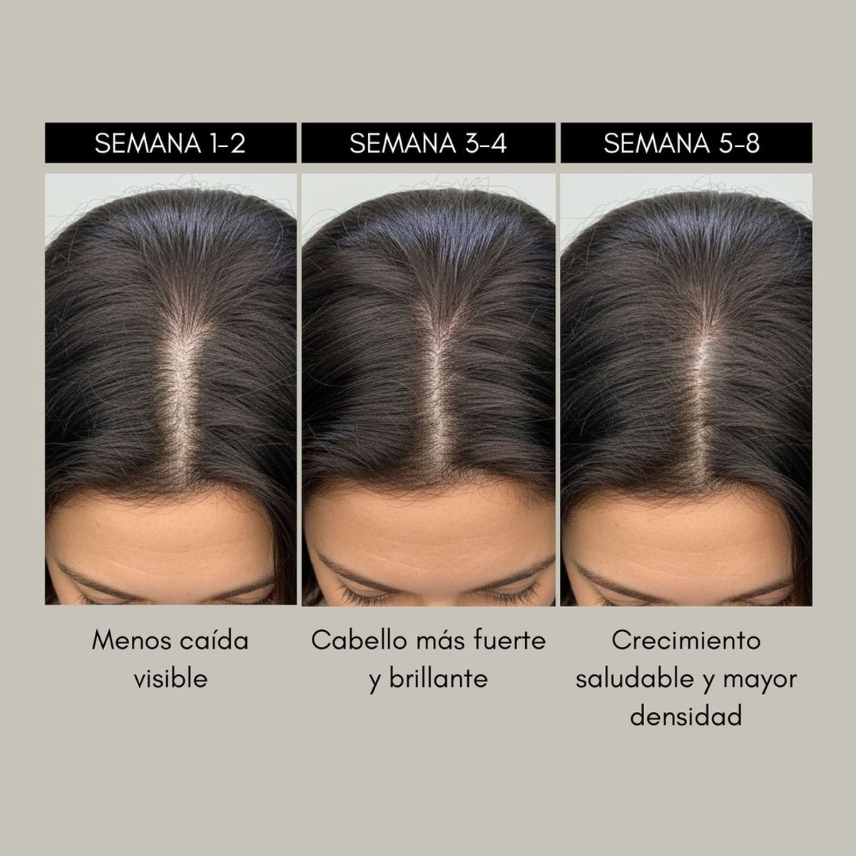 REBEL - RevitaMAX Estimulador Crecimiento Capilar