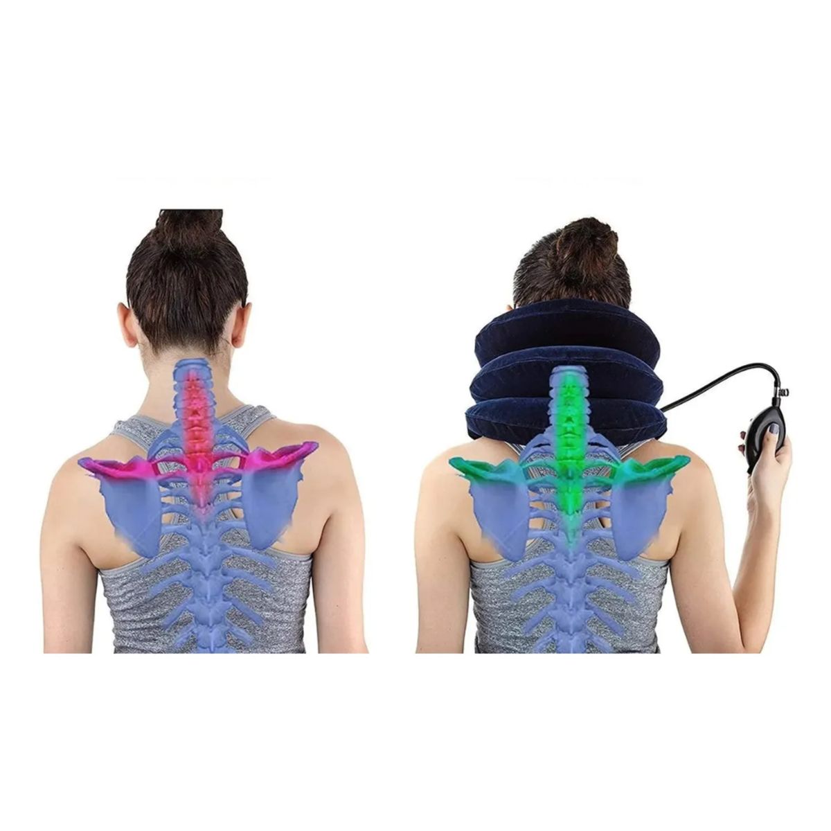 MOVI - Cuello Ortopédico Inflable