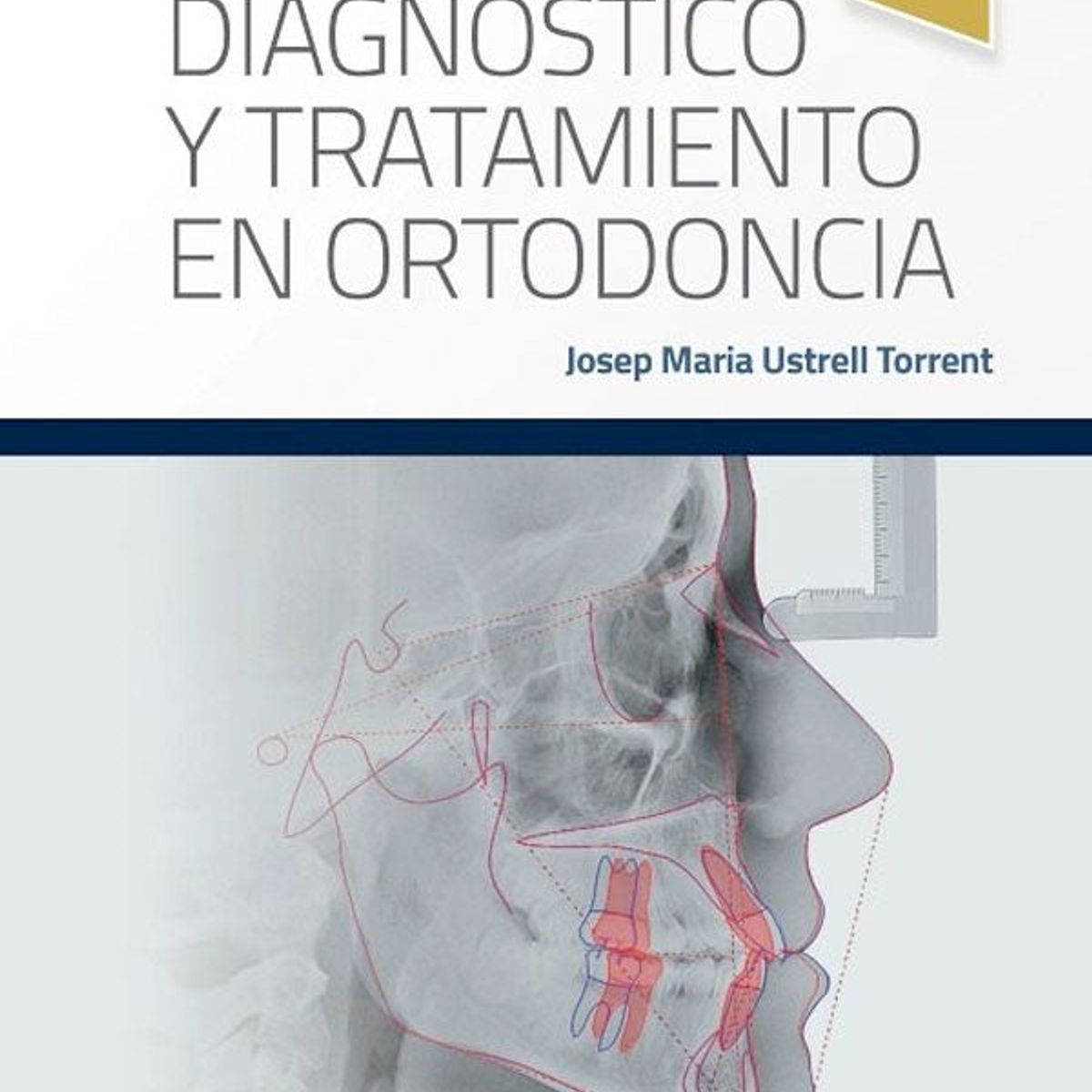 EDITORIAL MEDITERRANEO - Libro Diagnostico Y Tratamiento En Ortodoncia 2Ed.