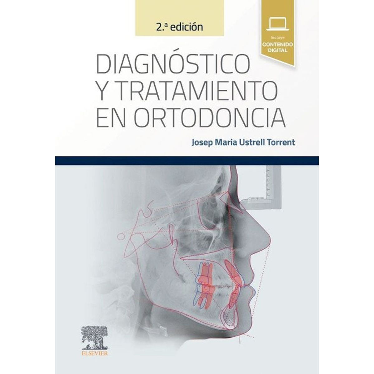 EDITORIAL MEDITERRANEO - Libro Diagnostico Y Tratamiento En Ortodoncia 2Ed.