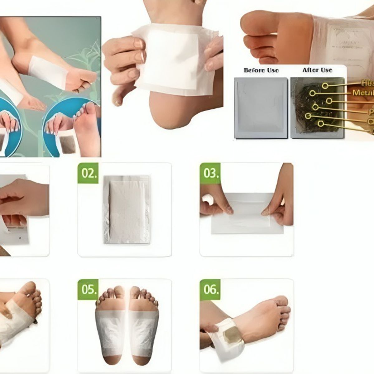 GENERICO - Set de 10 Parches Desintoxicación y Dolor para los Pies