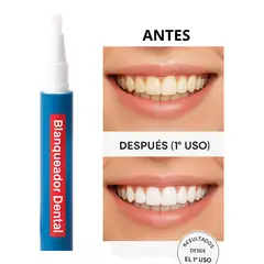 GENERICO - Lápiz Blanqueador dental instantáneo