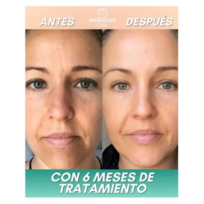 Imagen 2 del producto Parches Nanosolubles De Colageno Frente 6 Unidades