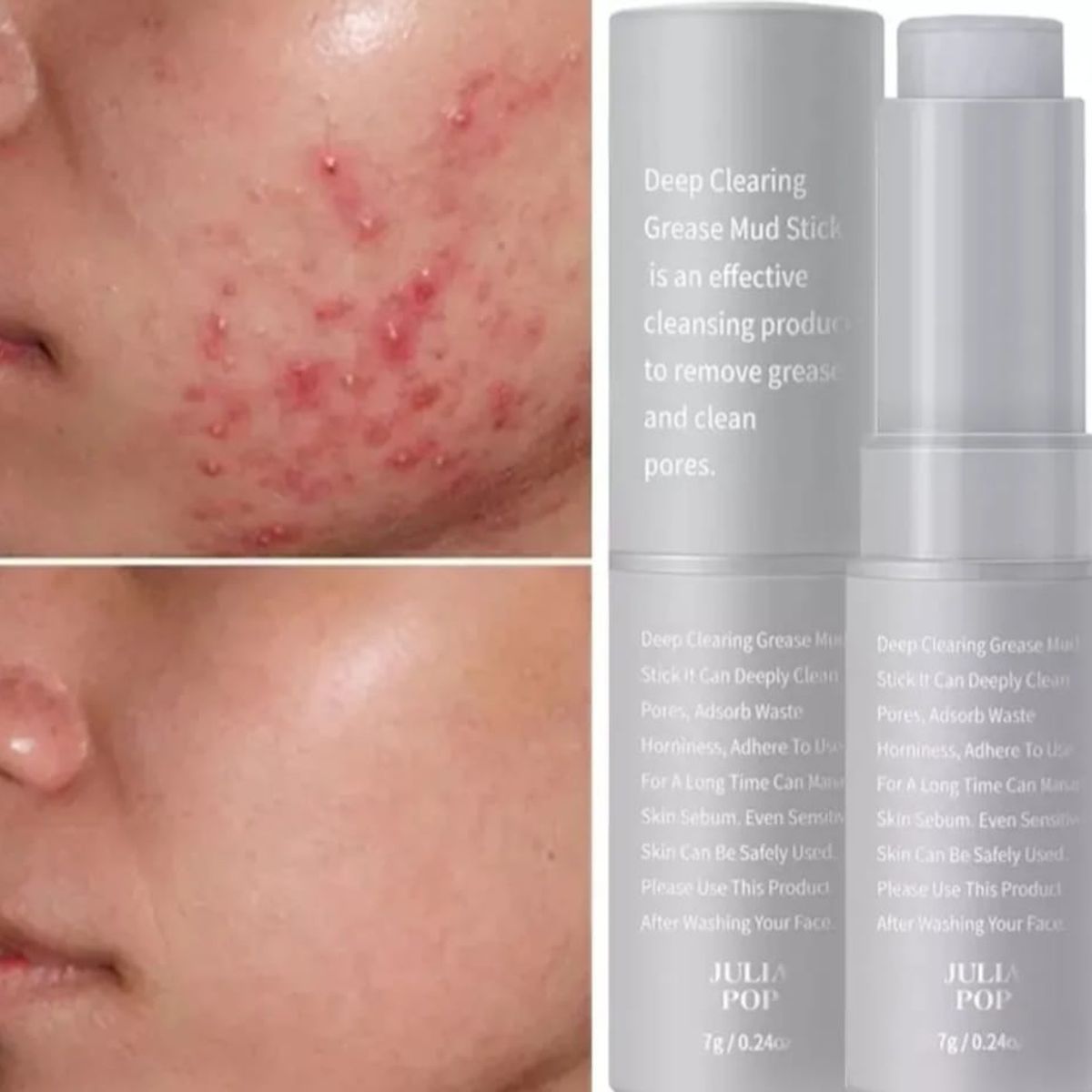 GENERICO - Barra Mascarilla De Arcilla Elimina Acne