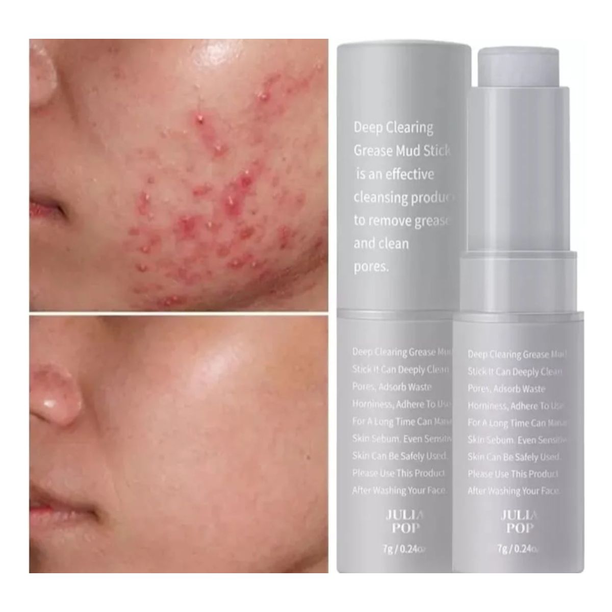 GENERICO - Barra Mascarilla De Arcilla Elimina Acne