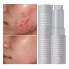 GENERICO - Barra Mascarilla De Arcilla Elimina Acne