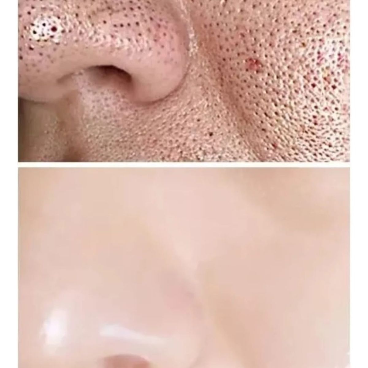 GENERICO - Barra Mascarilla Facial De Arcilla Blanca Elimina puntos Blancos