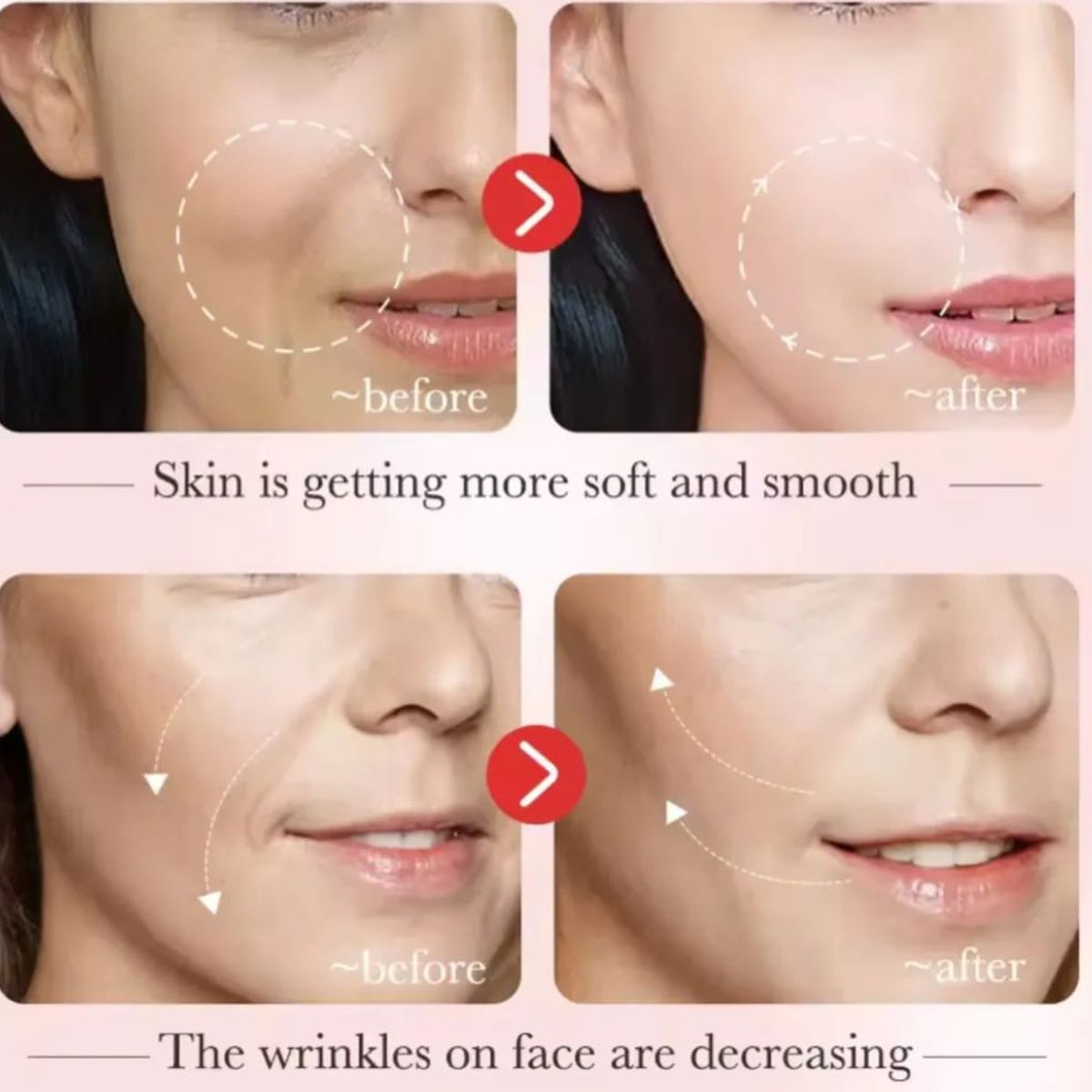 GENERICO - Set Facial Antiedad  Caracol Set Skincare