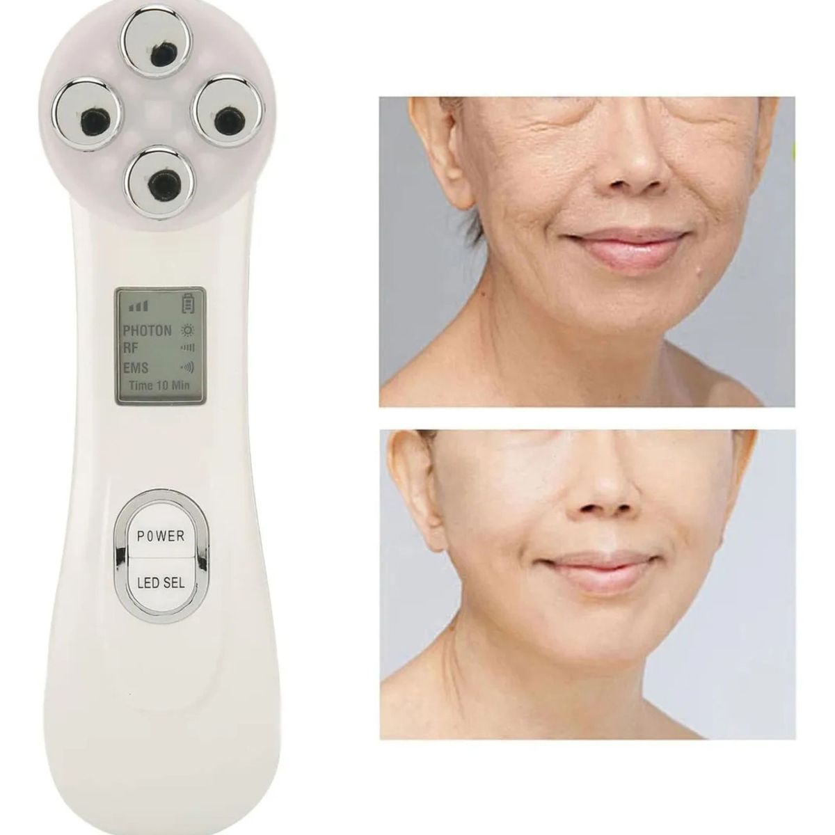 GENERICO - Masajeador ultrasónico facial con Luz LED Fototerapia