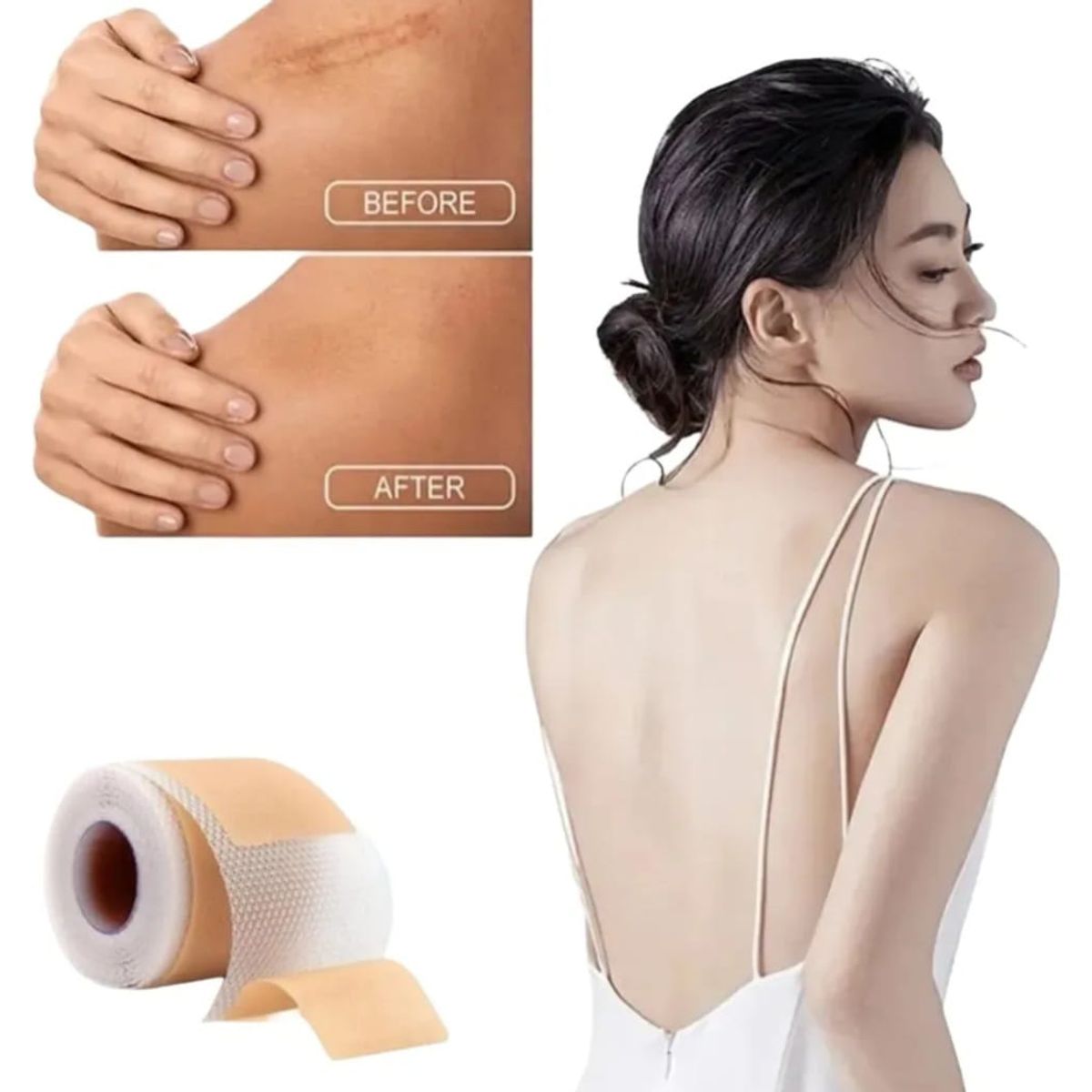 GENERICO - Parche de Silicona  para Cicatrices y Queloides rollo 4cmx1,5metros