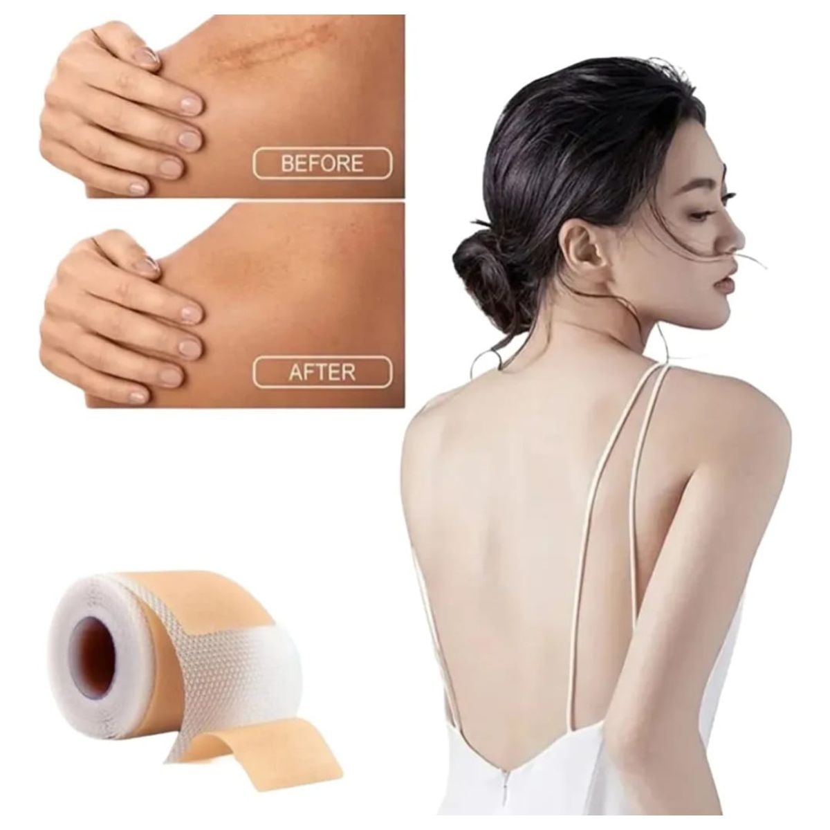 GENERICO - Parche de Silicona  para Cicatrices y Queloides rollo 4cmx1,5metros