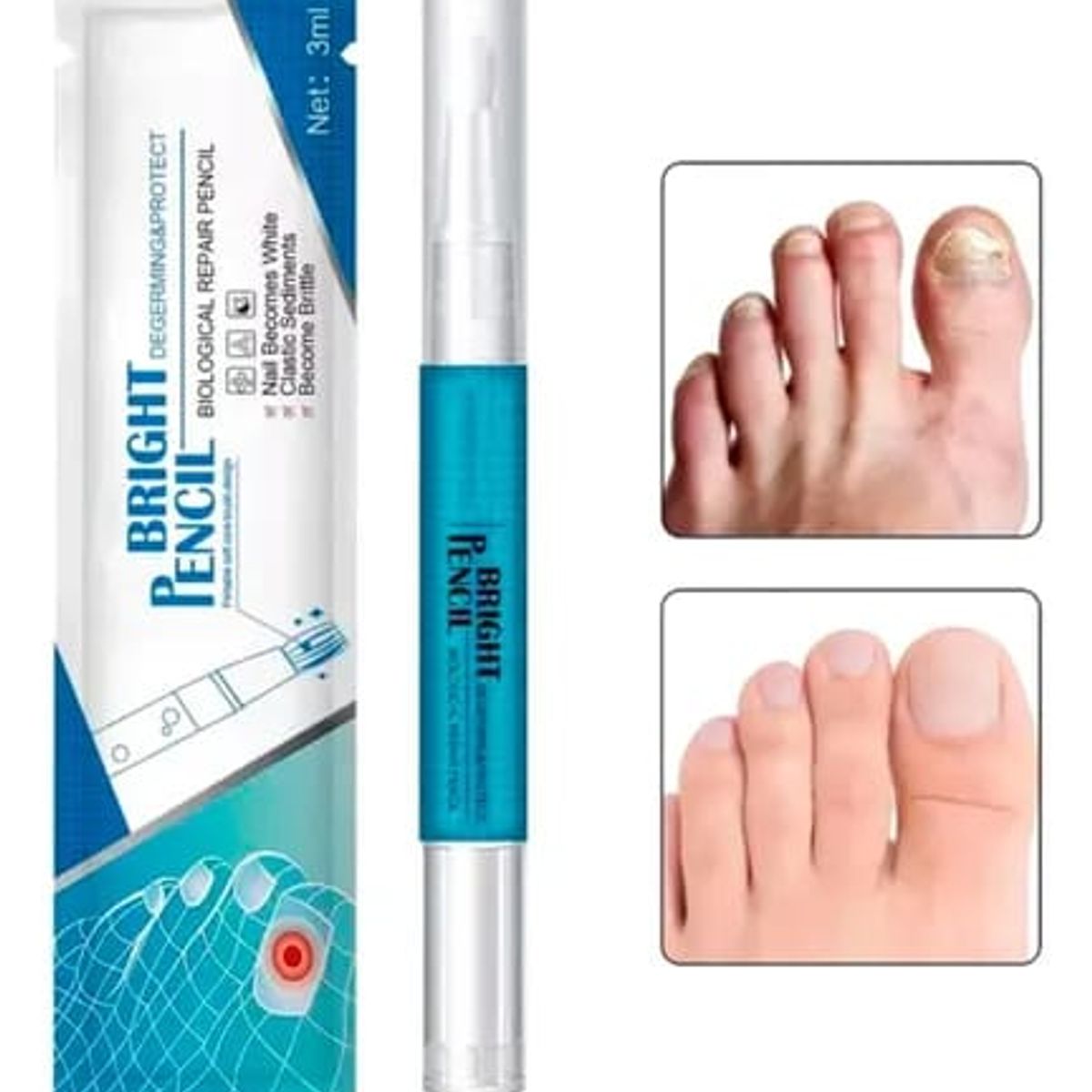 GENERICO - Lapiz Para Reparacion De Uñas Antihongos