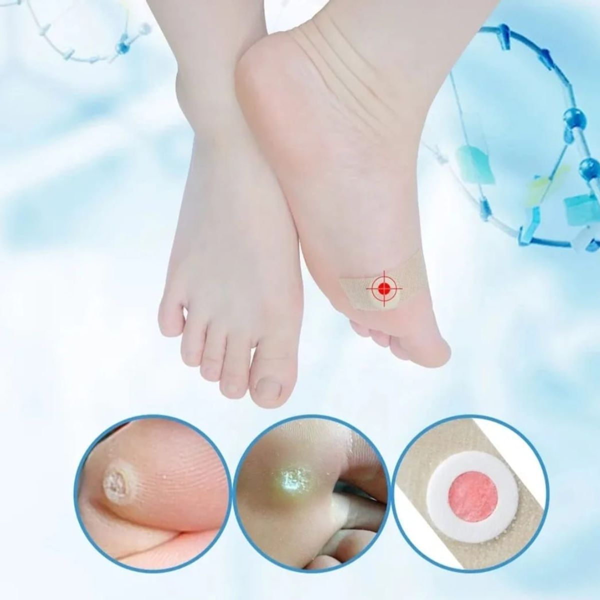 GENERICO - 20 Parches Para Eliminar Callos y Durezas del Pie
