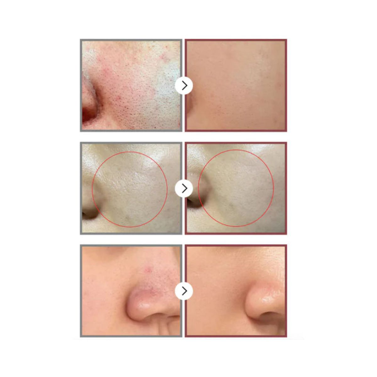 NUMBUZIN - Mascarilla de Tela Refinadora de Poros Cosmético Coreano 27  ml