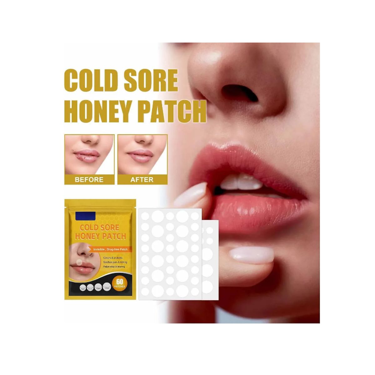 GENERICO - Parches Para El Herpes Labial Parches De Miel E Hidrocoloide