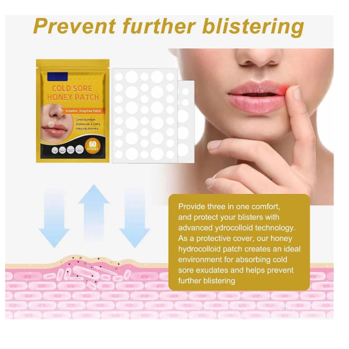 GENERICO - Parches Para El Herpes Labial Parches De Miel E Hidrocoloide