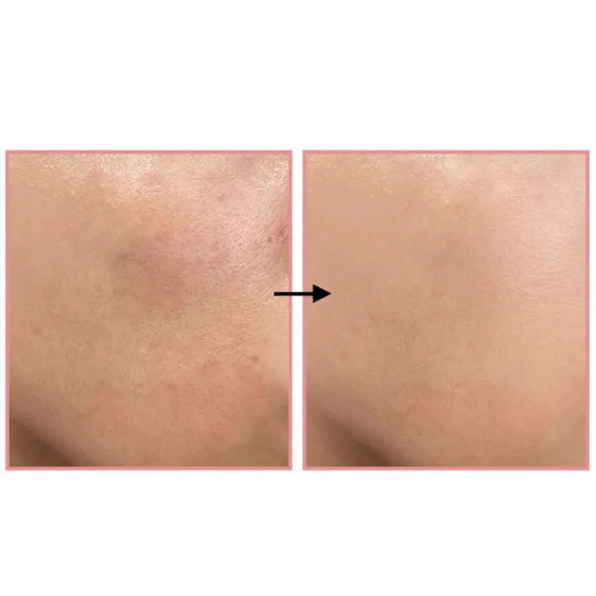 THELAVICOS - Toner Calmante y Control Sebo Cosmético Coreano 300 ml