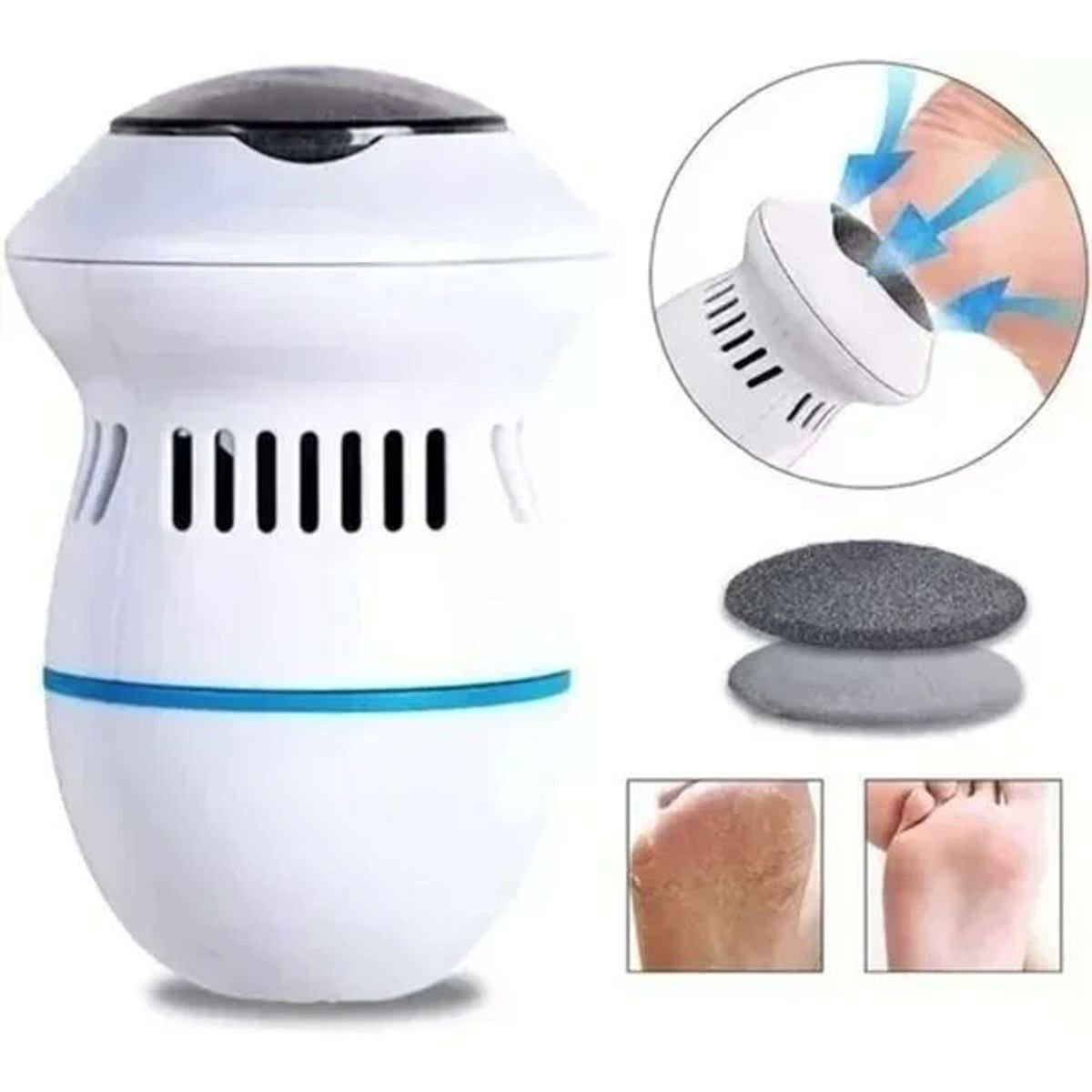 MOVI - REMOVEDOR QUITA CALLOS DUREZAS PULIDOR  PIES ELECTRICO