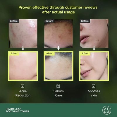 Imagen 2 del producto Tónico Calmante con 77% Extracto de Heartleaf Coreano 250 ml
