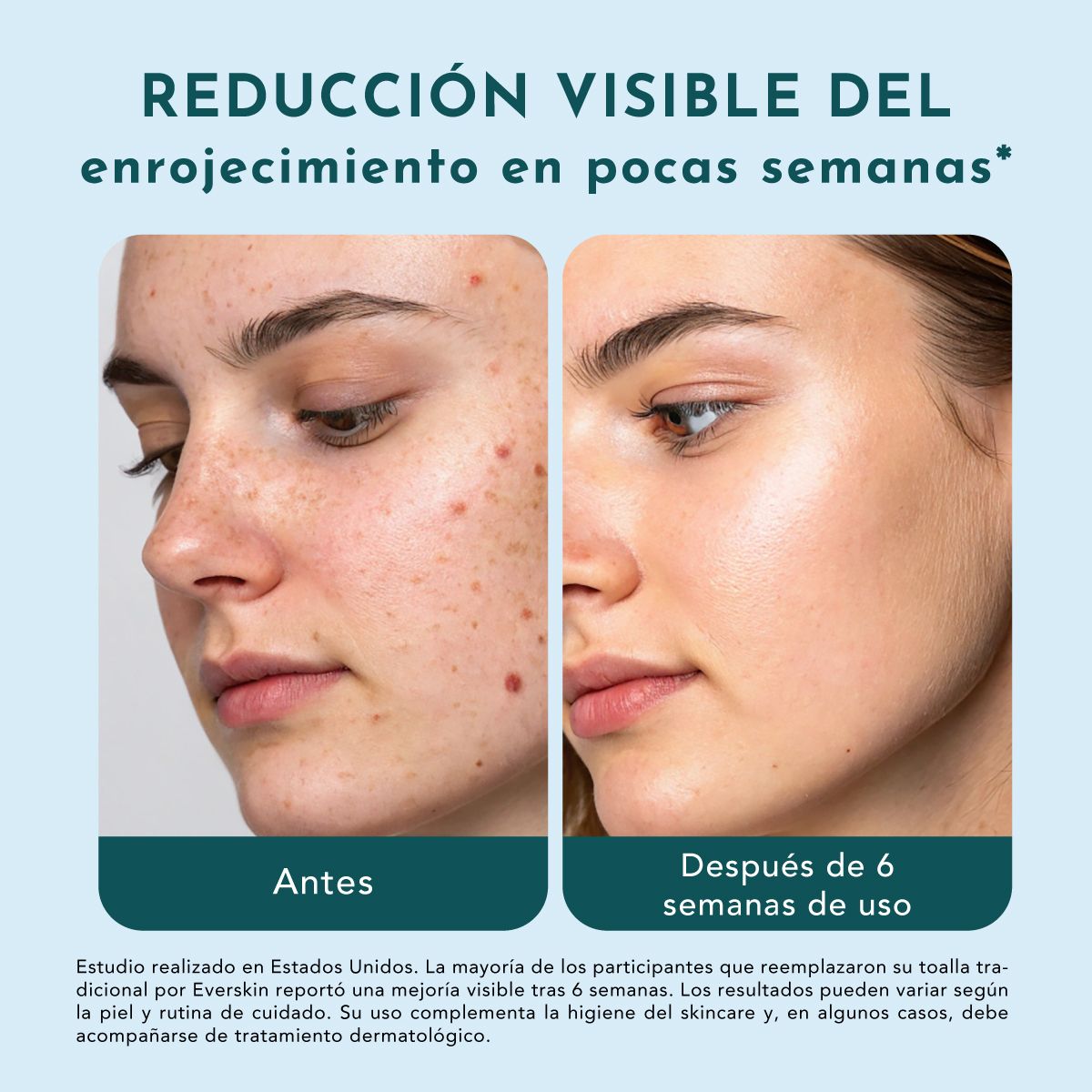 EVERSKIN - Pack 8 Toallas Faciales Premium 25 Unidades