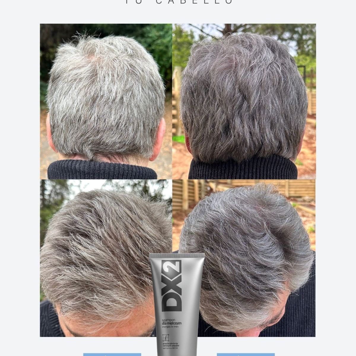 BIOLIFE IMPROVING YOU - DX2 Shampoo Anti-Canas para Hombres  Rejuvenece tu Cabello de Forma Natural