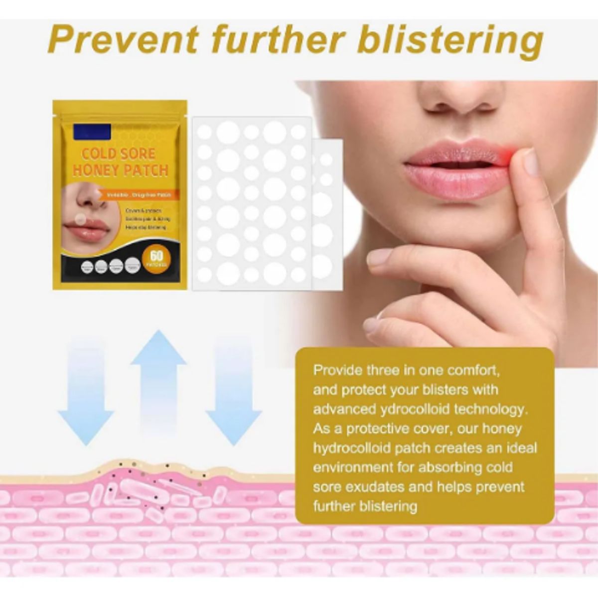 GENERICO - Parches Para El Herpes Labial Parches De Miel E Hidrocoloide