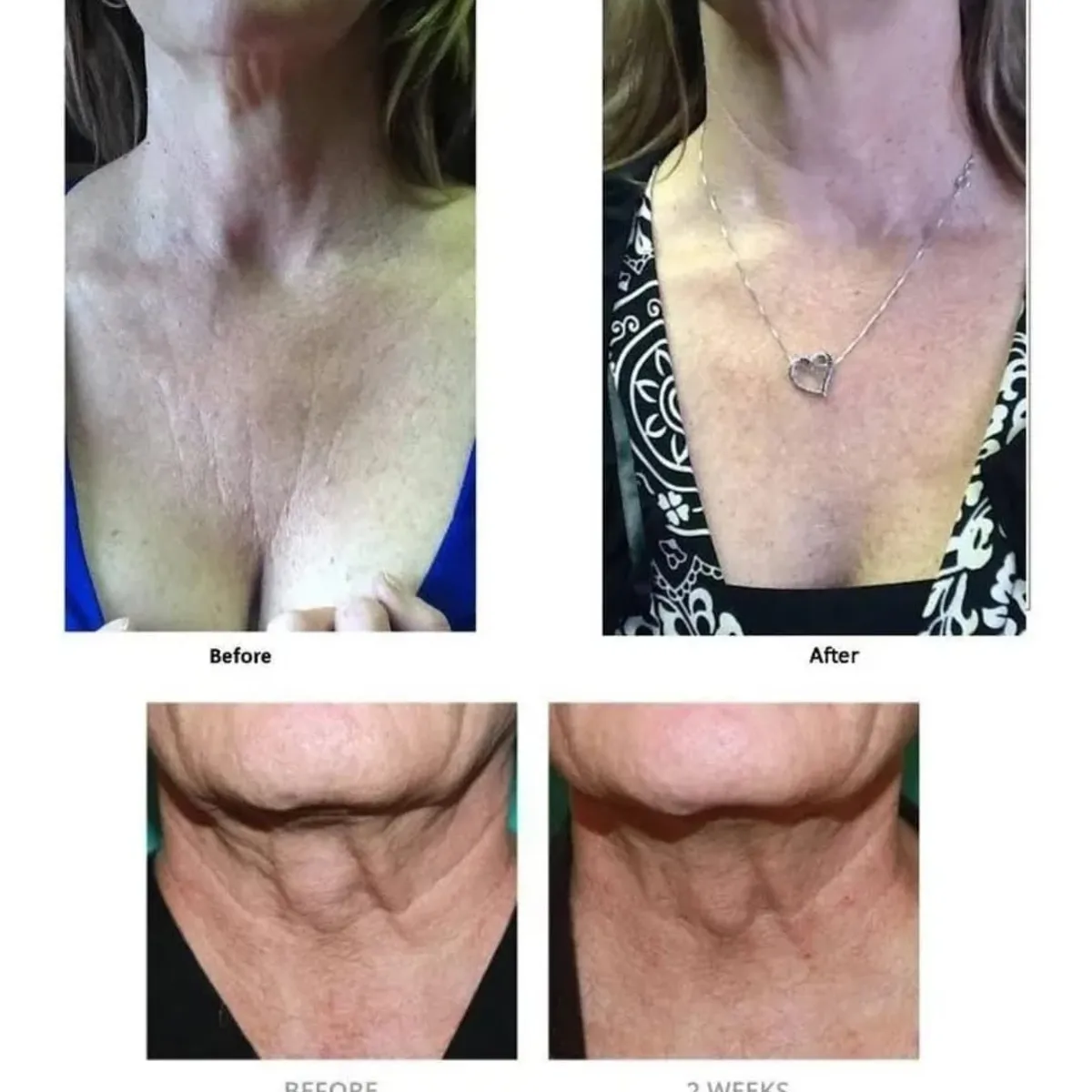 GENERICO - Crema Cuello y Escote  Con Colageno Reafirmante Antiedad