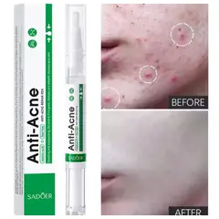 GENERICO - Esencia Anti-Acné con Ácido Azelaico y Tea Tree