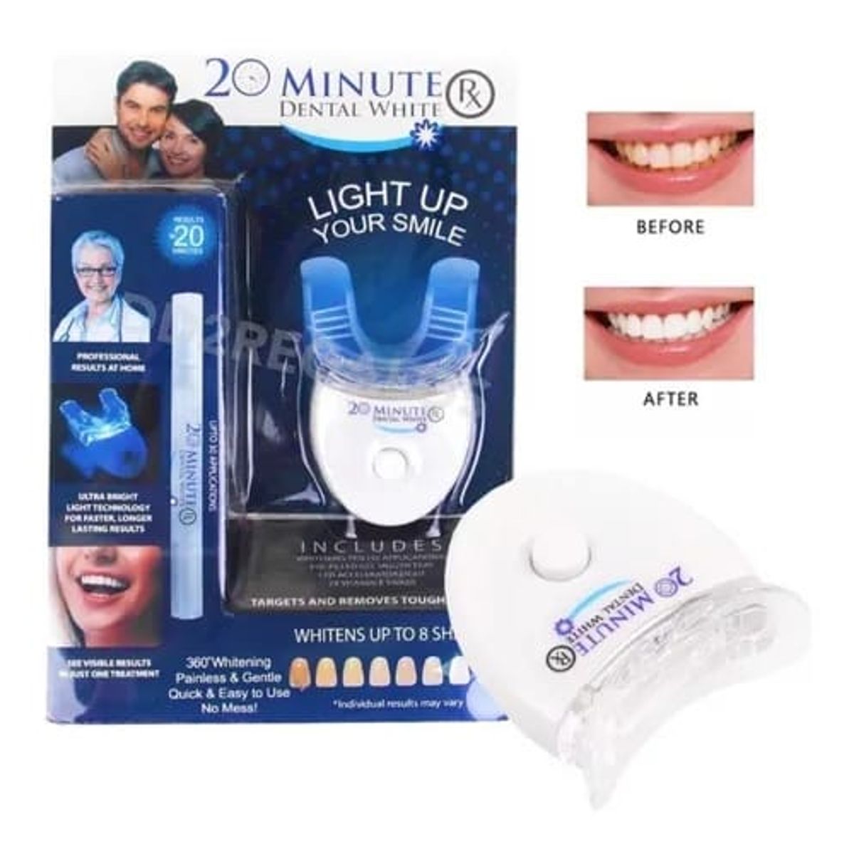 GENERICO - Set Blanqueamiento Dental 20 Minutos