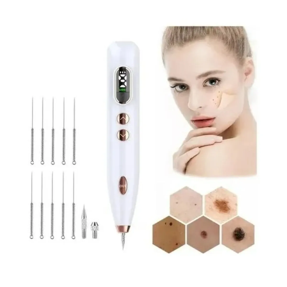 GENERICO - Lápiz Removedor De Lunares Removedor De Verrugas Manchas