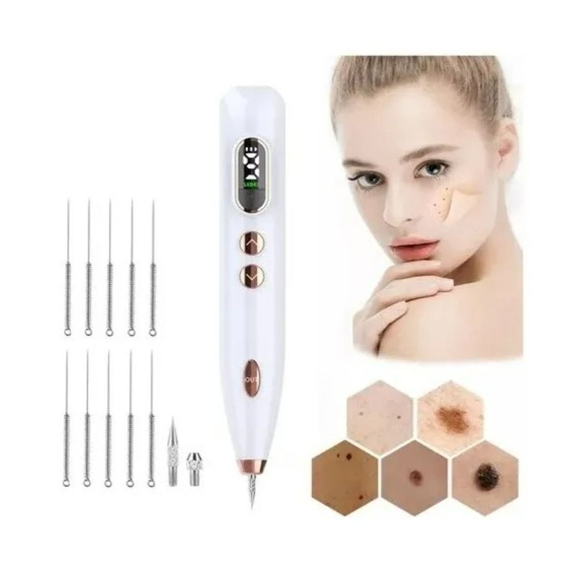 GENERICO - Lápiz Removedor De Lunares Removedor De Verrugas Manchas