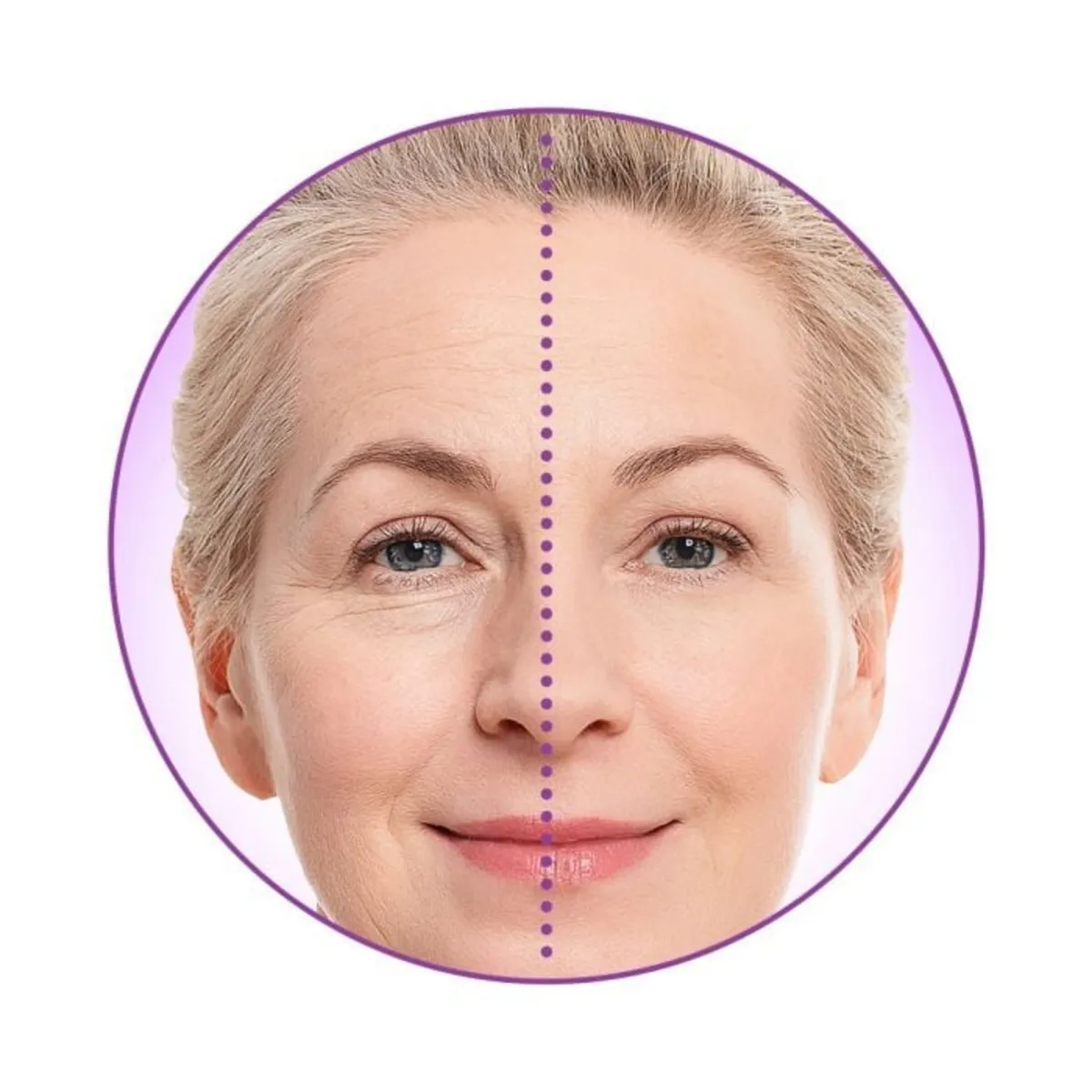 A3D - Removedor de Arrugas Instantáneo Lishe