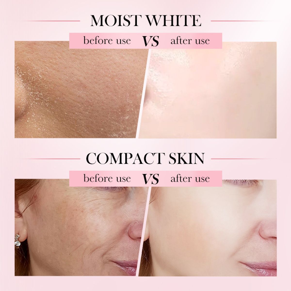 GENERICO - Serum Facial Multifuncional 4 en 1 Acido Hialuronico +Vitaminas