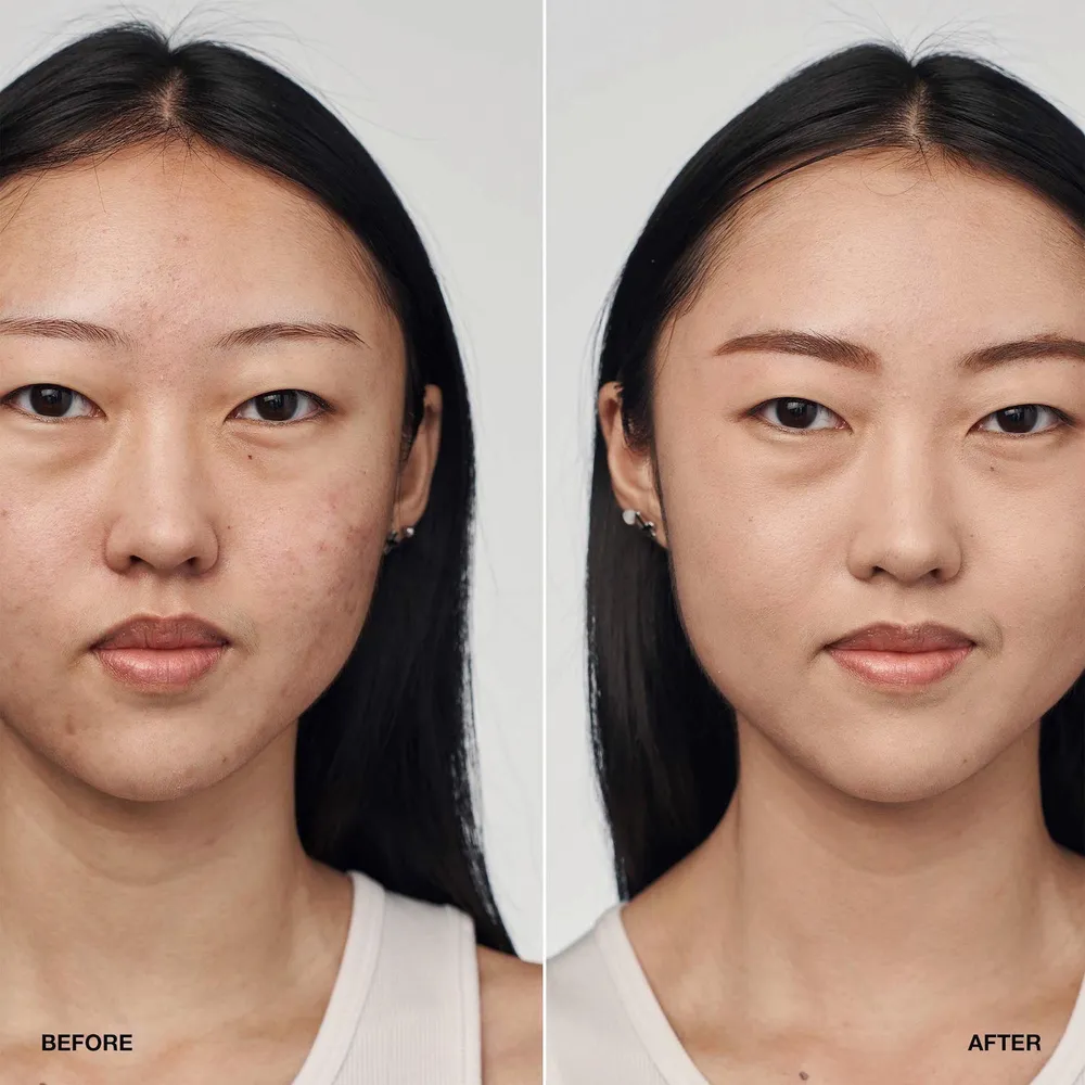 Clinique Even Better Clinical Serum Foundation SPF 20, foto 3