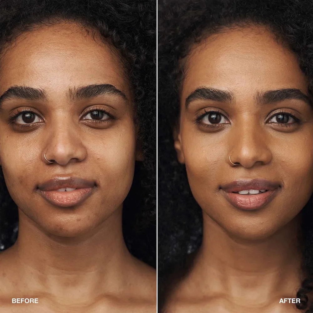 Clinique Even Better Clinical Serum Foundation SPF 20, foto 3