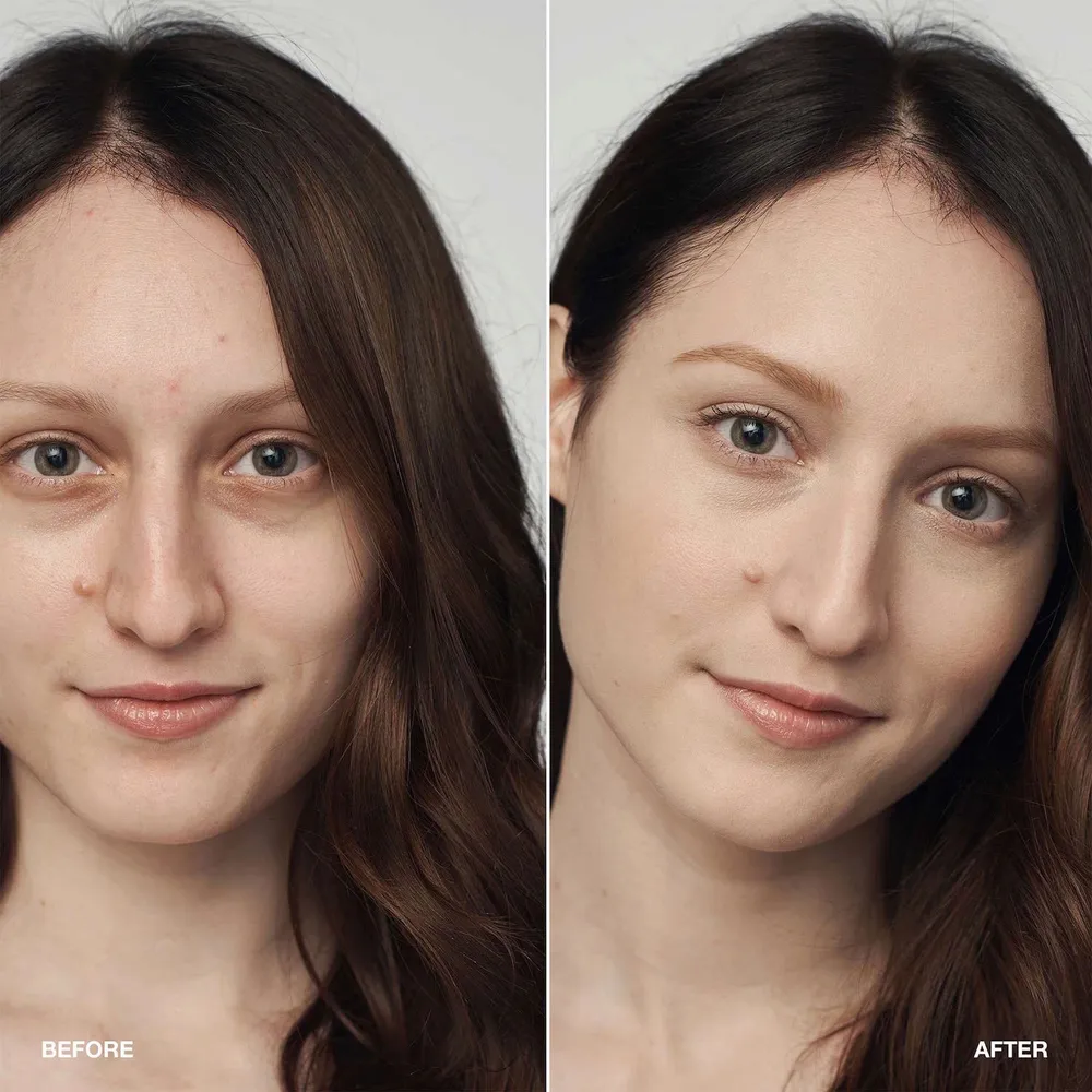 Clinique Even Better Clinical Serum Foundation SPF 20, foto 3