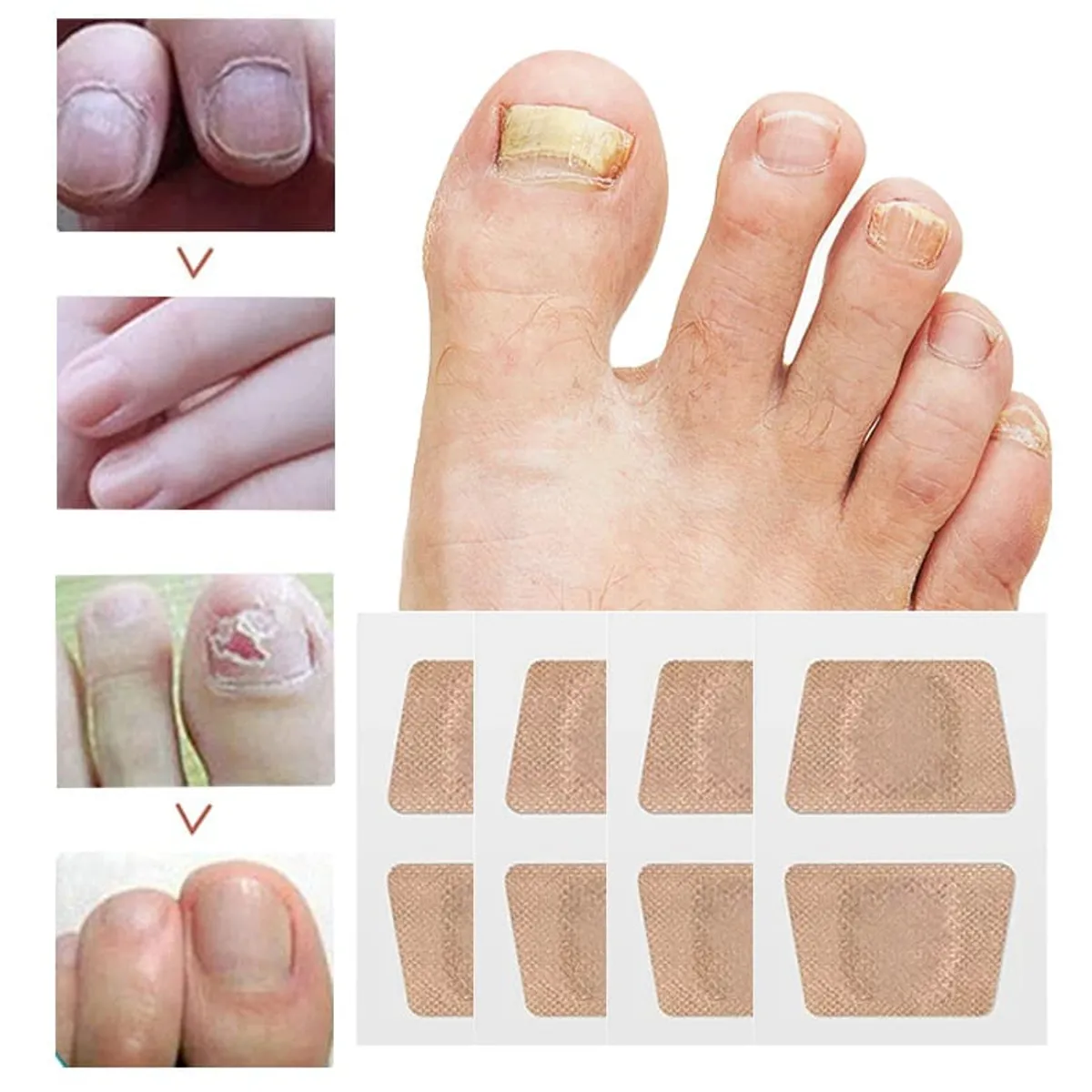 GENERICO - Parches Antihongos Para El Cuidado De Las Uñas 16 Unidades