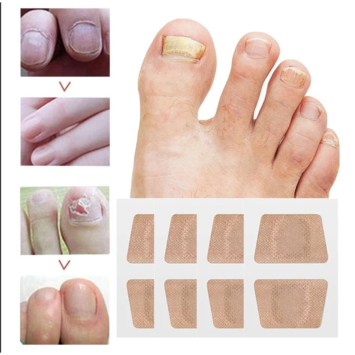 GENERICO - Parches Antihongos Para El Cuidado De Las Uñas 16 Unidades