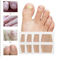 GENERICO - Parches Antihongos Para El Cuidado De Las Uñas 16 Unidades