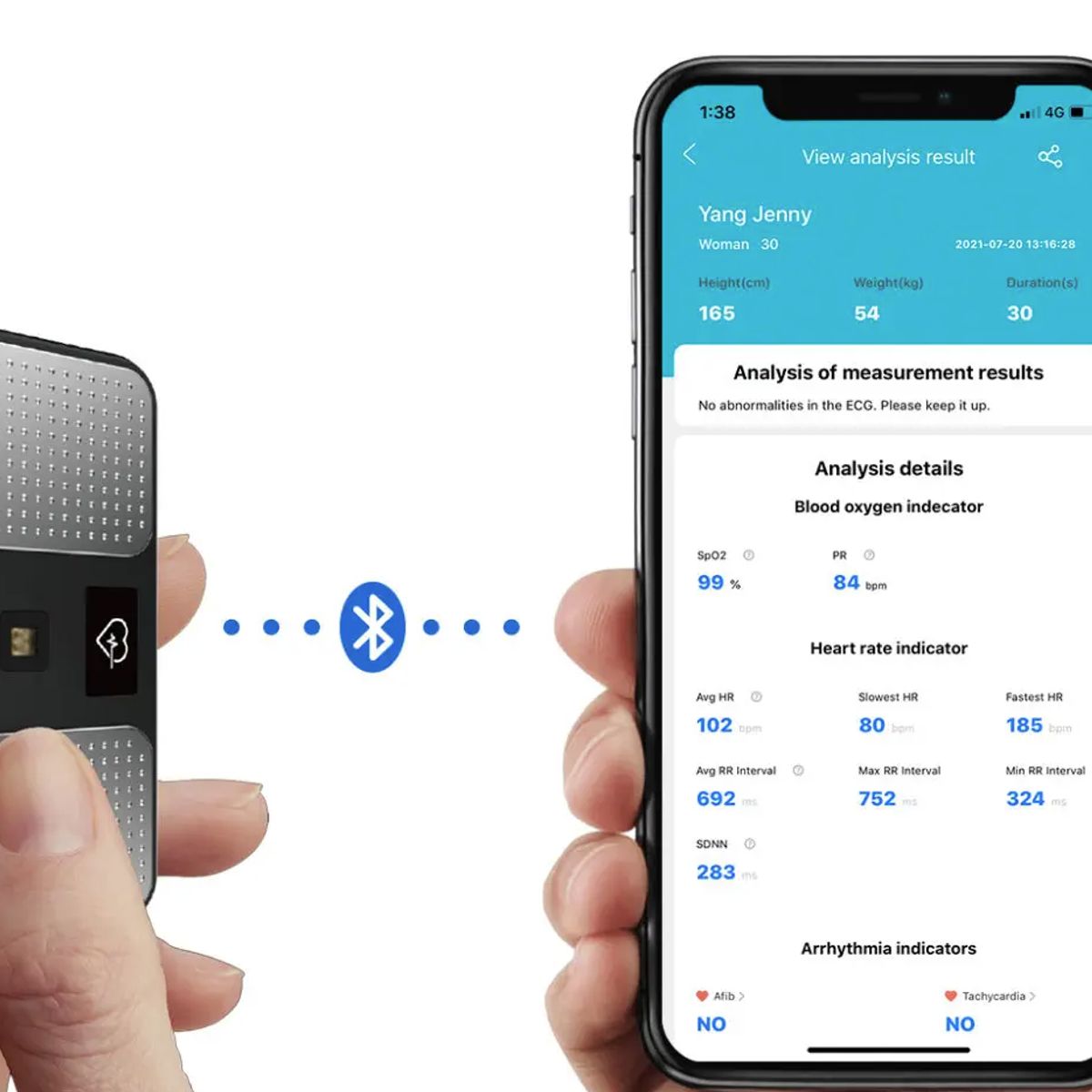 CHOICEMMED - Monitor ECG Portátil Bluetooth MD100C  Choicemmed