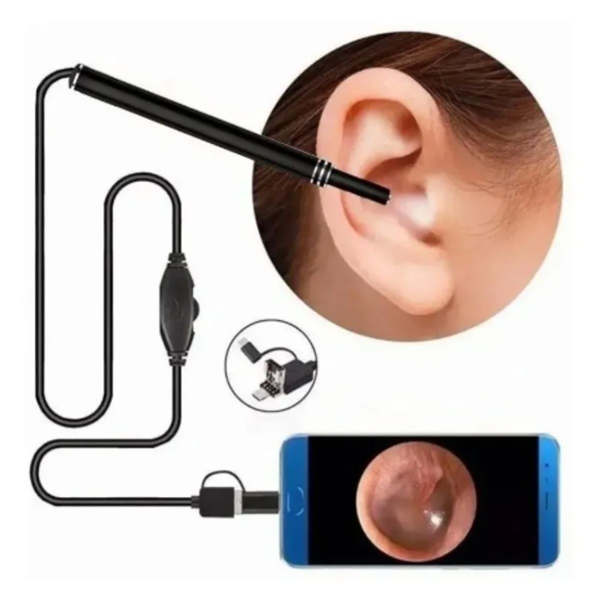 GENERICO - Limpiador De Oídos Con Cámara Usb Hd