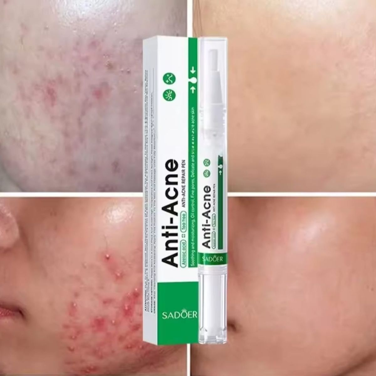 GENERICO - Lápiz Serum Anti-Acné  Ácido Azelaico y Tea Tree