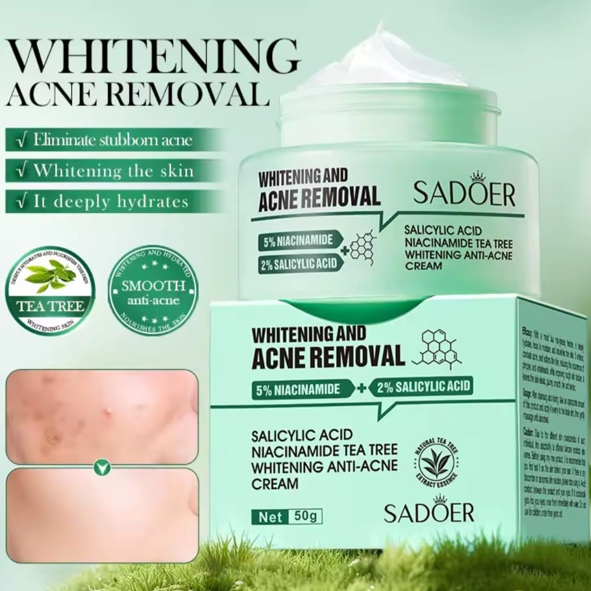 GENERICO - Crema Anti-Acné  Hidratación y Reparación Diaria