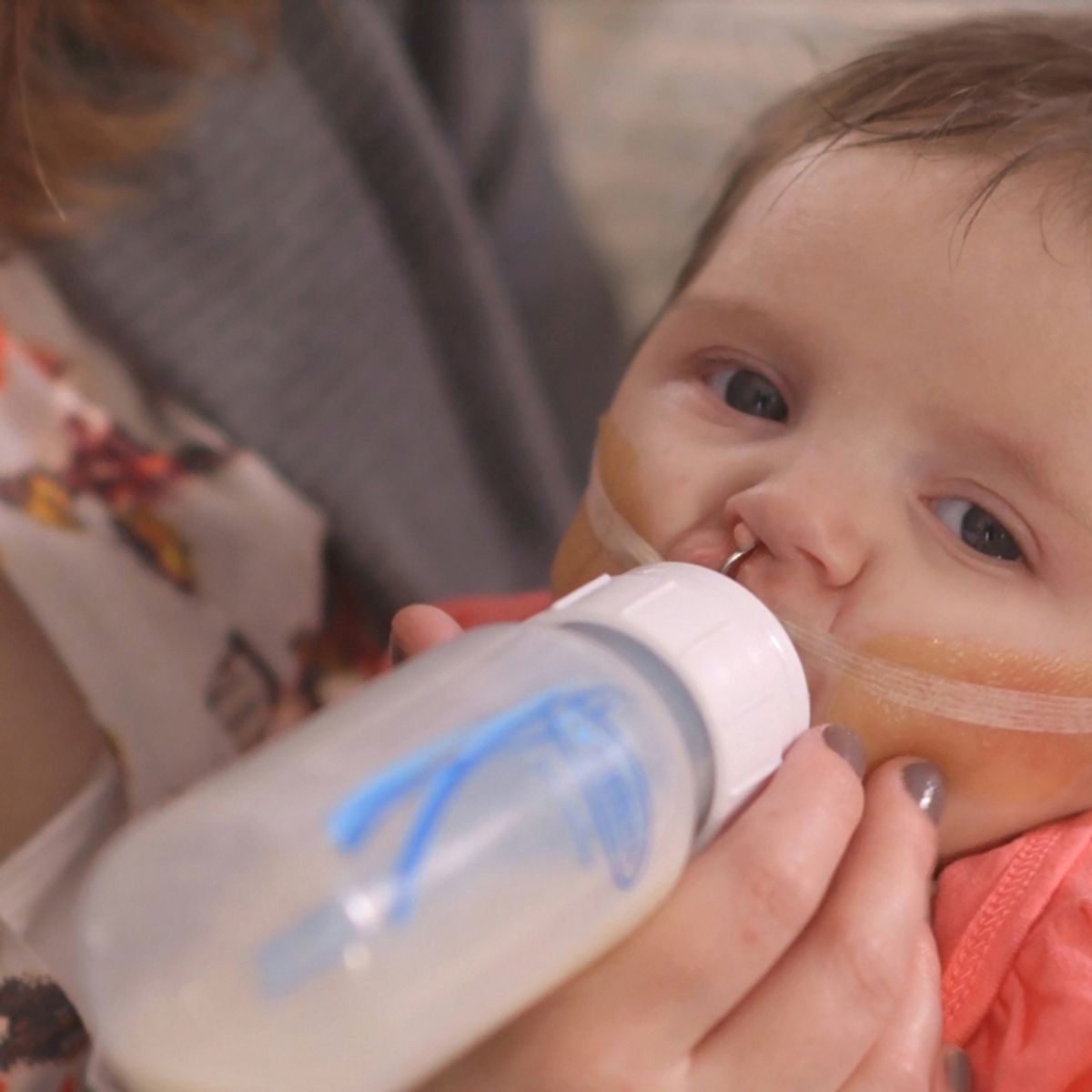 DR BROWN'S - Mamadera Dr Brown’s Necesidades Especiales Prematuro Anticólicos 250ml