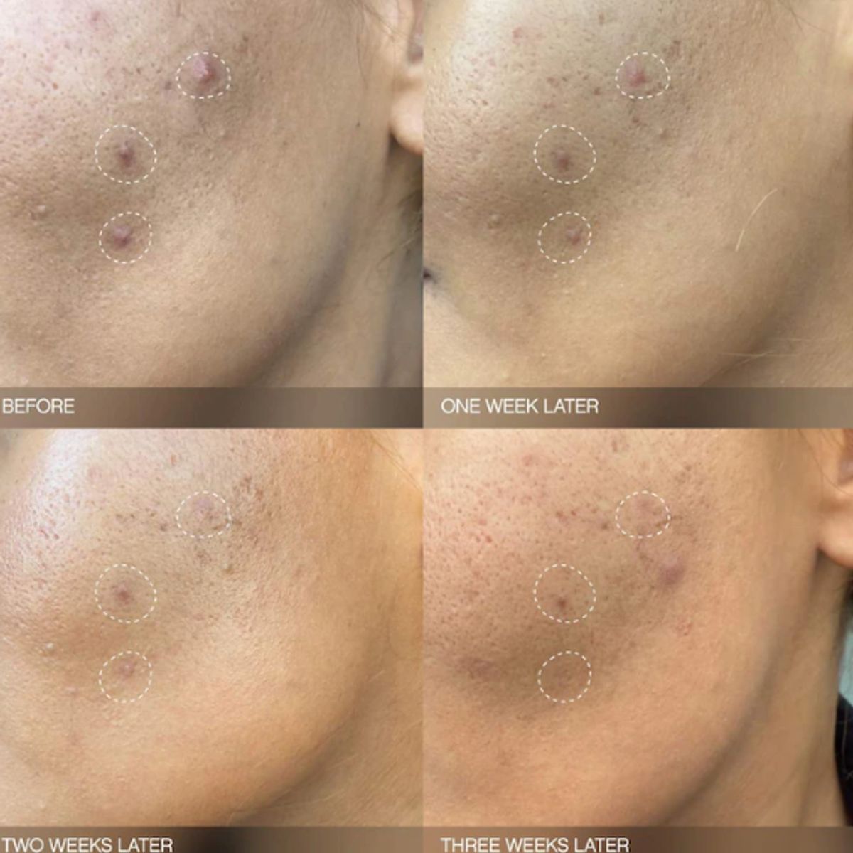 GENERICO - Serum Iluminador para Manchas y Decoloracion 30ml Topicals