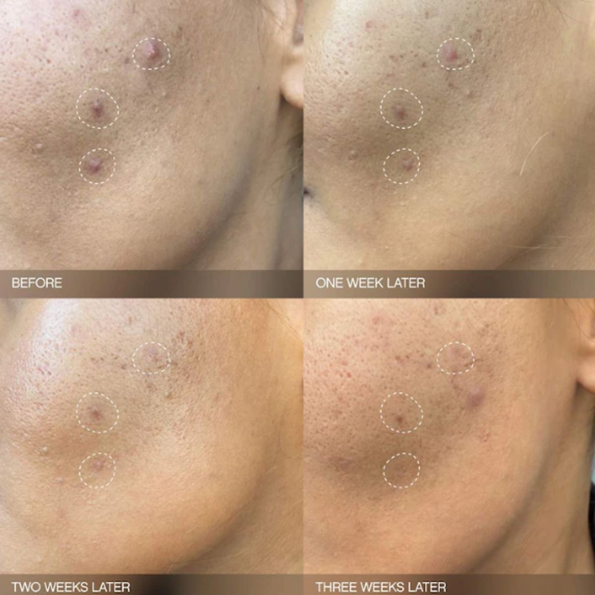 GENERICO - Mini Serum Iluminador para Manchas y Decoloracion 15ml Topicals