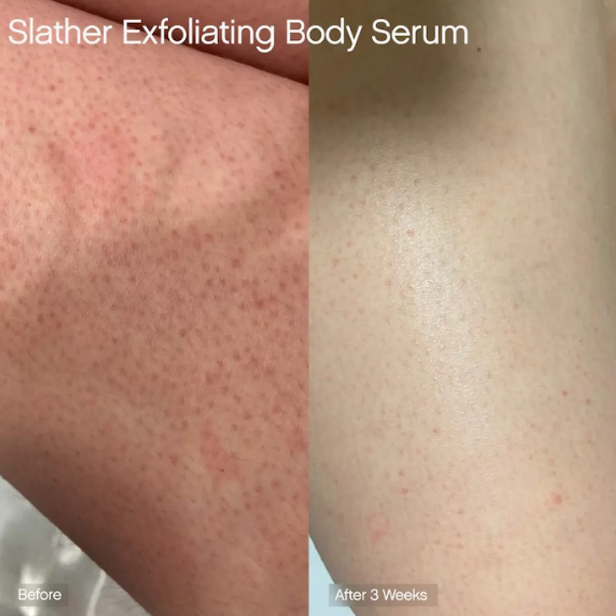 TOPICALS - Serum Corporal Exfoliante con Retinol y AHAs Slather Topicals 150ml