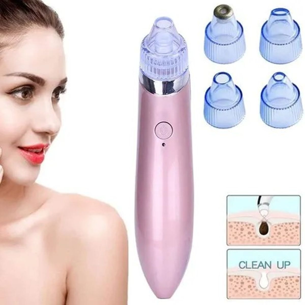 MOVI - Extractor y removedor de Puntos Negros